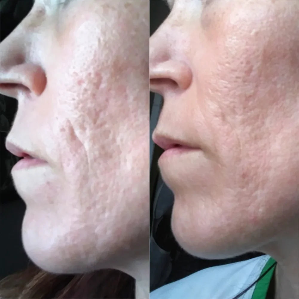 Genni before and after SkinnyFit Super Youth