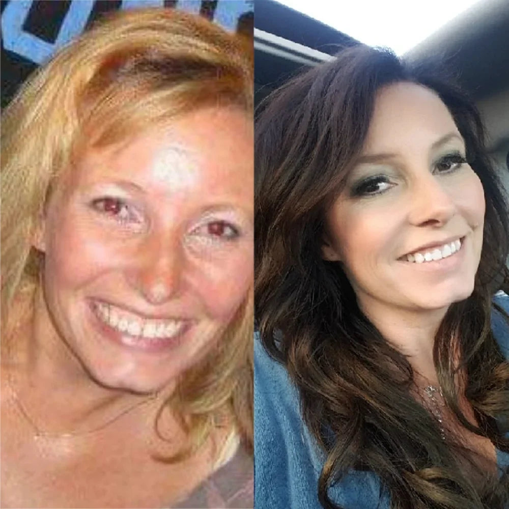 Melissa before and after SkinnyFit Super Youth