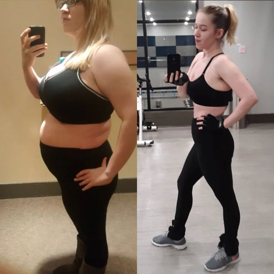 Miriam R., before and after on SkinnyFit