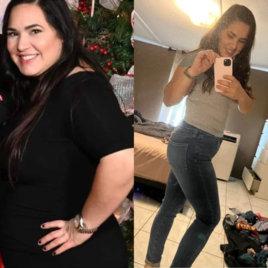 Vanessa C., before and after on SkinnyFit